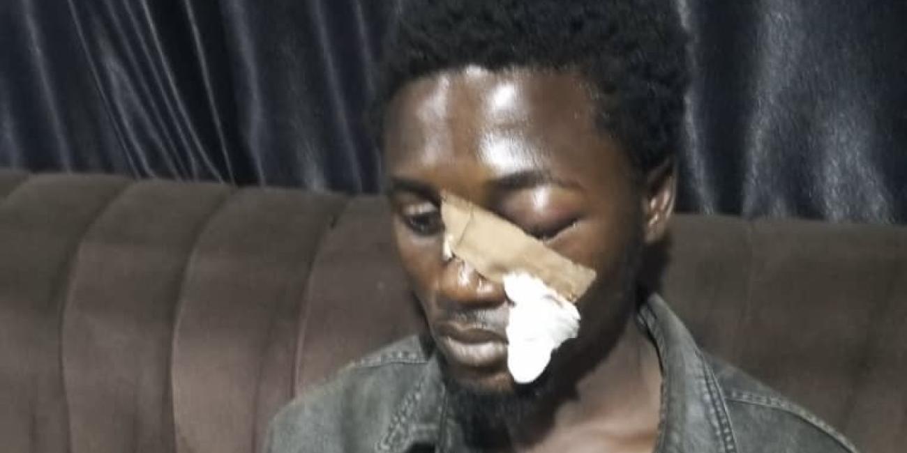 Nigerian Man Loses Eye After Police Fire Teargas At Close Range In Abuja, Another Shot In Katsina
