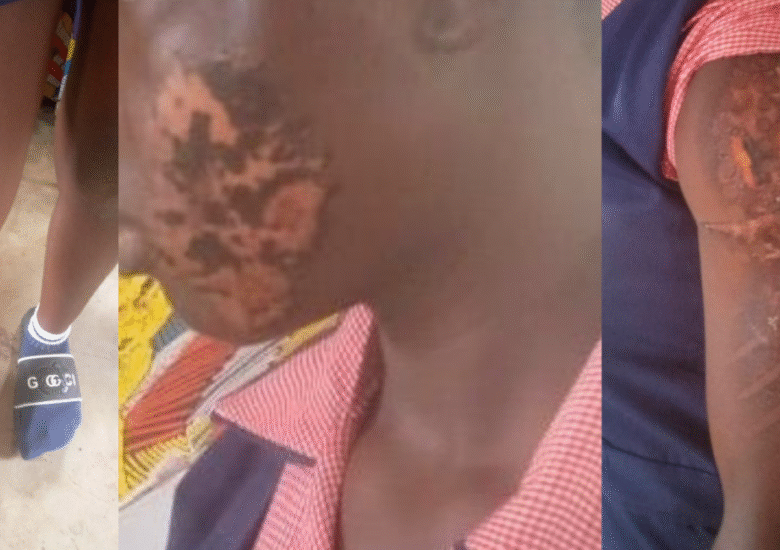 Woman Arrested In Anambra For Allegedly Using Hot Iron To Burn 17-Year-Old Domestic Worker