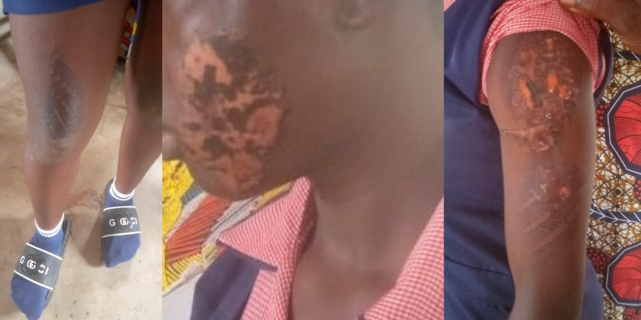 Woman Arrested In Anambra For Allegedly Using Hot Iron To Burn 17-Year-Old Domestic Worker